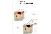 MicroPlasma
