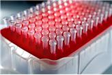 Końcówki do pipet automatycznych OMNITIP 0,5-10 µl (różne rodzaje/formy pakowania)