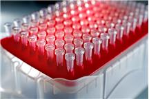 Końcówki do pipet automatycznych OMNITIP 0,5-10 µl (różne rodzaje/formy pakowania)