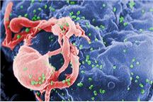 Wirus HIV (CDC Public Health Image Library) Wirus HIV (CDC Public Health Image Library)