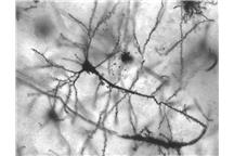 neuron, Foto: Wikimedia Commons neuron, Foto: Wikimedia Commons