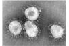Foto:  Centers for Disease Control and Prevention/Wikimedia Commons