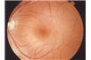 Foto: National Eye Institute/sciencedaily.com