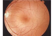 Foto: National Eye Institute/sciencedaily.com Foto: National Eye Institute/sciencedaily.com
