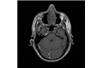 Nanotechnologia: Przełom w technice MRI