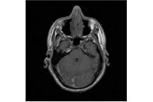 Nanotechnologia: Przełom w technice MRI