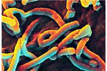 Opracowano szybki test diagnostyczny wykrywający wirusa Ebolę