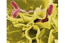Salmonella typhimurium (czerwona)- zdjęcie SEM/Wikipedia