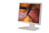 Monitor medyczny BEACON E150