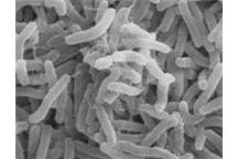 Nanomateriały sposobem na bakterie odporne na antybiotyki Nanomateriały sposobem na bakterie odporne na antybiotyki